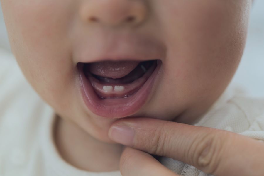 Παιδοδοντική vs Ορθοδοντική για παιδιά: Πότε πρέπει να πάει για πρώτη φορά στον οδοντίατρο;